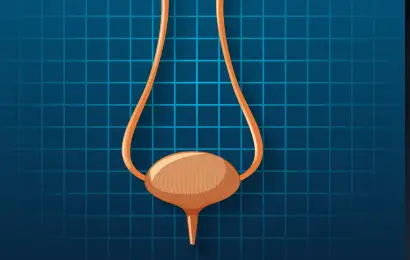 Cáncer de vejiga