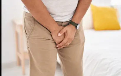 Varicocele
